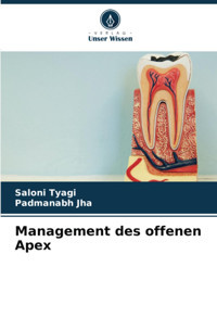 Management Des Offenen Apex Tyagi, Saloni Verlag Unser Wissen