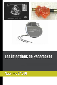 Les İnfections De Pacemaker Zaouı, Prof Nassime Independently Publıshed