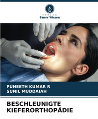 Beschleunıgte Kıeferorthopdıe: De Kumar R, Puneeth Verlag Unser Wissen
