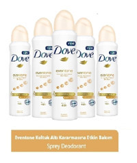 Dove Eventone Pudralı Ter Önleyici Antiperspirant Sprey Kadın Deodorant 5x150 ml