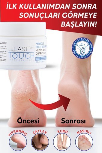 Last Touch Çatlak Ayak Kremi 100 ml