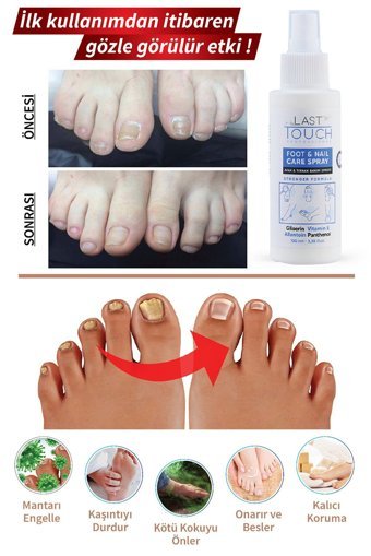 Last Touch Mantar Ayak Kremi 100 ml