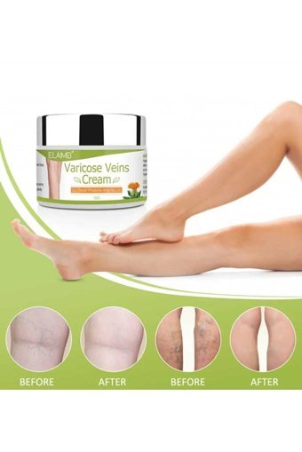 Elaımeı Varicose Veins Bakım Ayak Kremi 100 ml