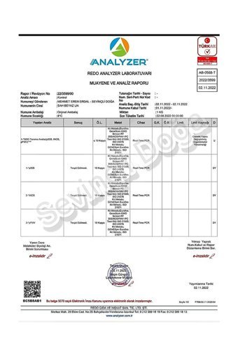 Sevinçli Doğa Yaş Ekşi Maya 100 gr