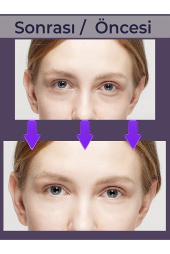 Luminate Kafein 5% C Vitamin 2% Aydınlatıcı Serum 20 ml