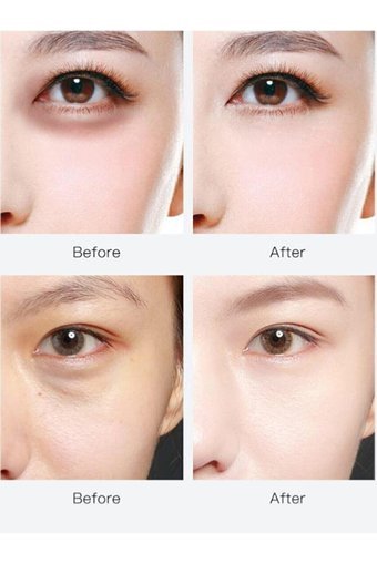 Avemor Göz Altı Jel Maske 60 Adet