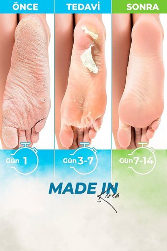 Dr. Meloso Ölü Deri-Çatlak Çorap Tipi Ayak Peeling Maskesi