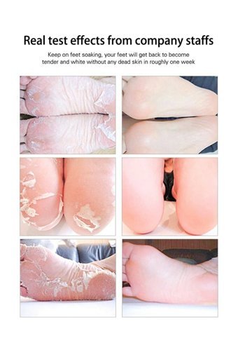 Poyrazglobal Ölü Deri-Çatlak Çorap Tipi Ayak Peeling Maskesi