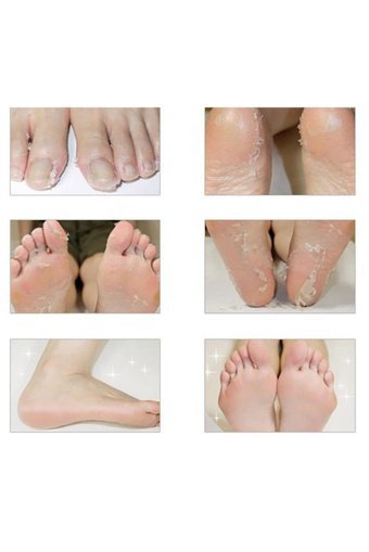 Epazzar Ölü Deri-Çatlak Çorap Tipi Ayak Peeling Maskesi
