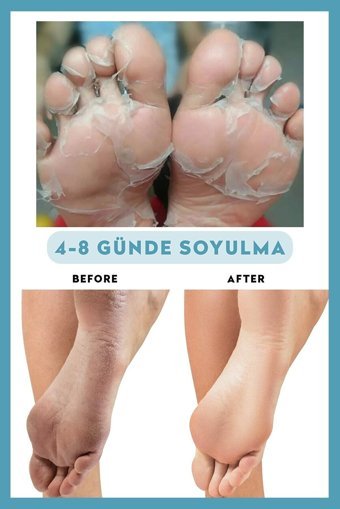Dermokil Exfoliating Ölü Deri-Çatlak Çorap Tipi Ayak Maskesi
