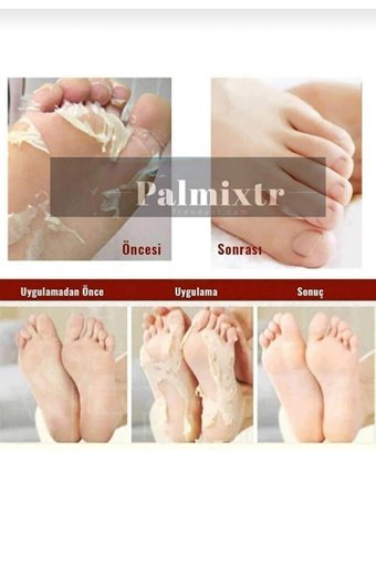 Carel Ölü Deri-Çatlak Çorap Tipi Ayak Peeling Maskesi