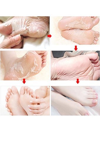 Glosse Nemlendirici Çorap Tipi Ayak Peeling Maskesi