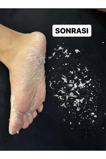 Hodaf Exfoliating Ölü Deri-Çatlak Çorap Tipi Ayak Peeling Maskesi 2 Adet