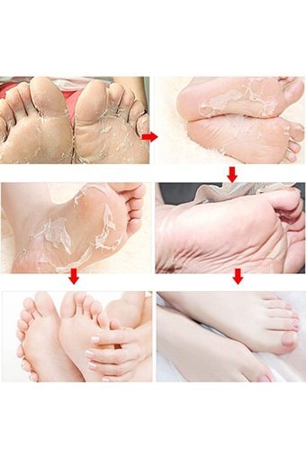 Movel Ölü Deri Çorap Tipi Ayak Peeling Maskesi