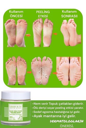 Eslbeauty Egzama-Mantar Aloe Veralı Soyulan Ayak Peeling Maskesi