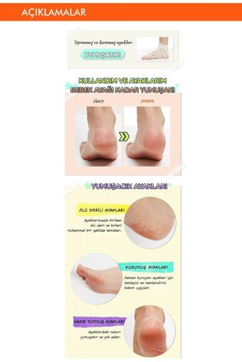 Missha Ölü Deri Çorap Tipi Ayak Peeling Maskesi