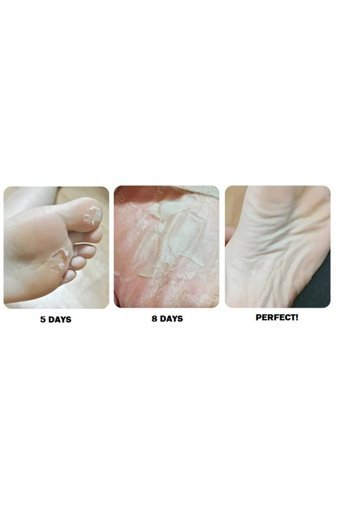 Rituel De Beaute Nasır Çorap Tipi Ayak Peeling Maskesi