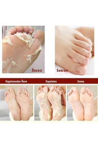 Loovitech Exfoliating Nemlendirici Çorap Tipi Ayak Peeling Maskesi