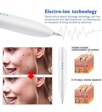 Jewval 400 mAH Tüm Ciltler İçin Tek Başlıklı Şarjlı Titreşimli Yüz Temizleme Cihazı Beyaz