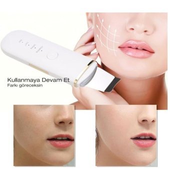 Transvital Ultrasonik 400 mAH Tüm Ciltler İçin Tek Başlıklı Şarjlı Titreşimli Yüz Temizleme Cihazı Siyah