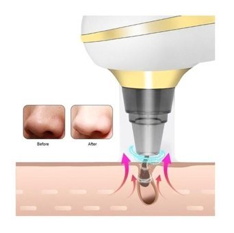 Worryfree Tüm Ciltler İçin Tek Başlıklı Buharlı Şarjlı Titreşimli Vakumlu Yüz Temizleme Cihazı Siyah