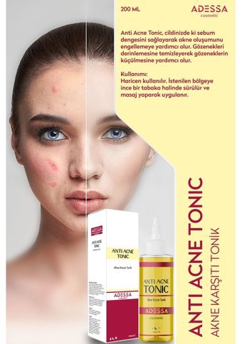 Adessa Anti Acne Tüm Cilt Tipleri İçin Likit Tonik 200 ml