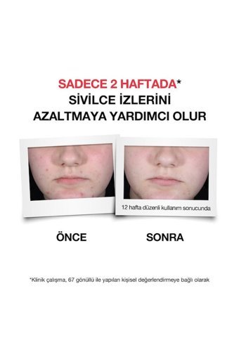 Neutrogena Krem Yüz Serumu 30 ml
