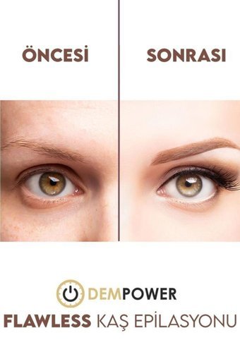 Dempower Dp-63 Yüz İçin Çift Başlıklı Lazer Epilasyon Aleti