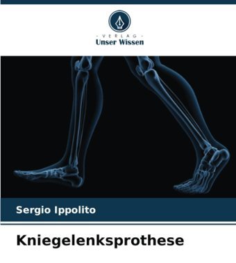 Kniegelenksprothesede Ippolito, Sergio Verlag Unser Wissen