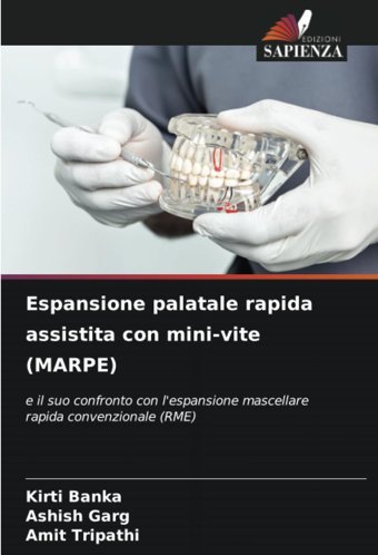 Espansione Palatale Rapida Assistita Con Mini-Vite (Marpe): E İl Suo Confronto Con L'Espansione Mascellare Rapida Convenzionale (Rme) Banka, Kirti Edizioni Sapienza