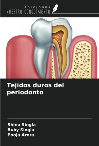 Tejidos Duros Del Periodonto Singla, Shinu Ediciones Nuestro Conocimiento