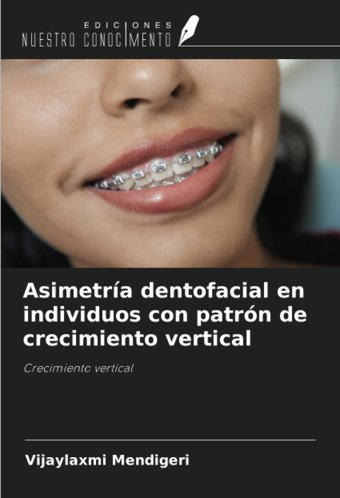 Asimetra Dentofacial En İndividuos Con Patrn De Crecimiento Vertical: Crecimiento Vertical Mendigeri, Vijaylaxmi Ediciones Nuestro Conocimiento