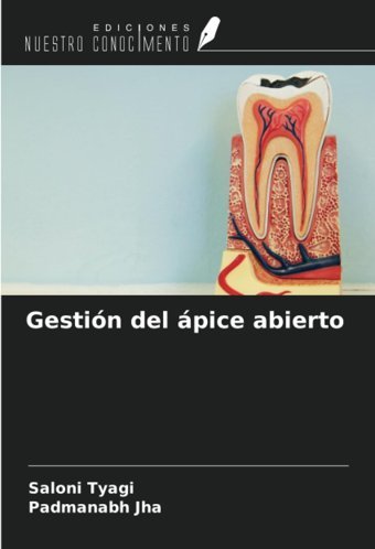 Gestin Del Pice Abierto Tyagi, Saloni Ediciones Nuestro Conocimiento