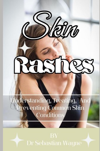 Skin Rashes: Understanding, Treating, And Preventing Skin Conditions Wayne, Dr Sebastian Independently Publıshed