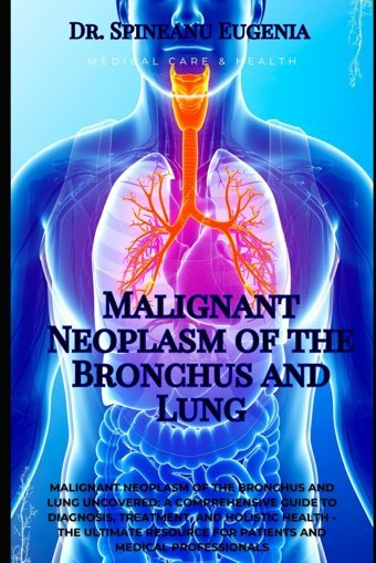 Malignant Neoplasm Of The Bronchus And Lung Eugenia, Dr. Spineanu Independently Publıshed
