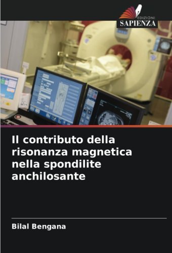 Il Contributo Della Risonanza Magnetica Nella Spondilite Anchilosante Bengana, Bilal Edizioni Sapienza