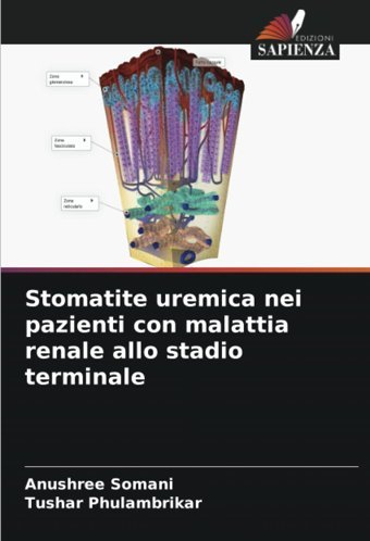 Stomatite Uremica Nei Pazienti Con Malattia Renale Allo Stadio Terminale: De Somani, Anushree Edizioni Sapienza