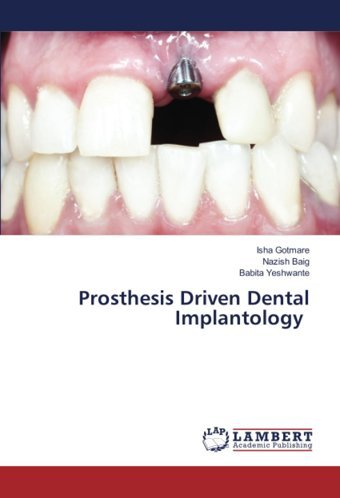 Prosthesis Driven Dental Implantology Gotmare, Isha Lap Lambert Academic Publishing