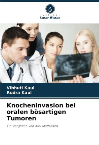 Knocheninvasion Bei Oralen Bösartigen Tumoren: Ein Vergleich Von Drei Methoden Kaul, Vibhuti Verlag Unser Wissen