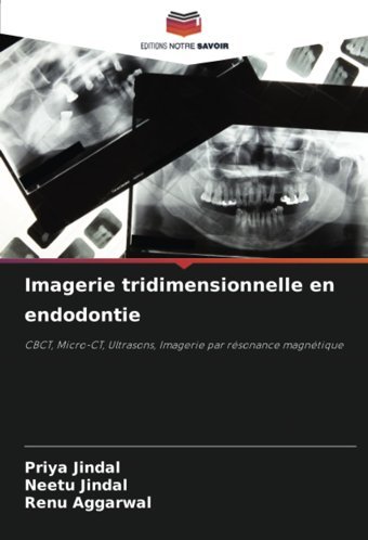 Imagerie Tridimensionnelle En Endodontie: Cbct, Micro-Ct, Ultrasons, Imagerie Par Rsonance Magntique Jindal, Priya Editions Notre Savoir