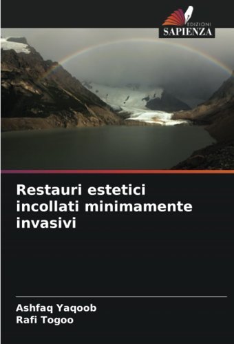Restauri Estetici İncollati Minimamente İnvasivi: De Yaqoob, Ashfaq Edizioni Sapienza