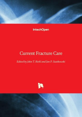 Current Fracture Care Intechopen