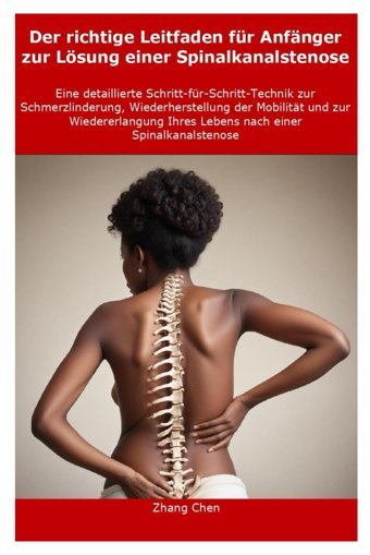 Der Richtige Leitfaden Für Anfnger Zur Lösung Einer Spinalkanalstenose: Eine Detaillierte Schritt-Für-Schritt-Technik Zur Schmerzlinderung, Wiederherstellung Der Mobilitt Und Zur Wiedererlangung Ihr Chen, Zhang Independently Publıshed