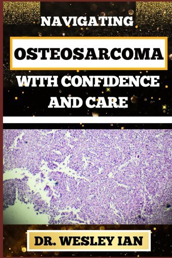 Navıgatıng Osteosarcoma Wıth Confıdence And Care: Mastering The Journey And Embracing Change For Confronting Cancer For Holistic Healing And Vibrant Wellness Ian, Dr. Wesley Independently Publıshed