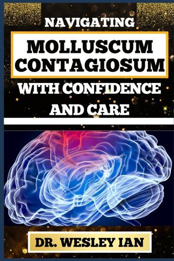 Navıgatıng Molluscum Contagıosum Wıth Confıdence And Care: Mastering The Journey And Empowering Strategies For Skin Maintenance And Healthy Lifestyle Ian, Dr. Wesley Independently Publıshed
