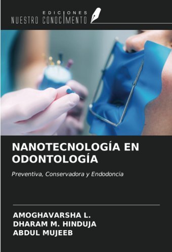 Nanotecnologa En Odontologa: Preventiva, Conservadora Y Endodoncia L., Amoghavarsha Ediciones Nuestro Conocimiento