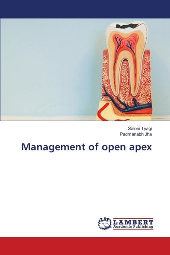 Management Of Open Apex: De Tyagi, Saloni Lap Lambert Academic Publishing