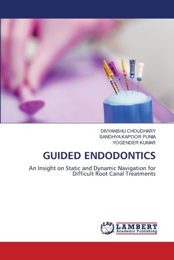 Guıded Endodontıcs: An Insight On Static And Dynamic Navigation For Difficult Root Canal Treatments Choudhary, Dıvyanshu Lap Lambert Academic Publishing