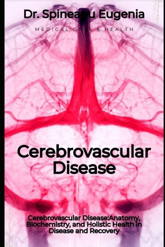 Cerebrovascular Disease: Unveiling The Interplay Of Anatomy, Biochemistry, And Holistic Health İn Disease And Recovery Eugenia, Dr. Spineanu Independently Publıshed