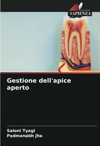 Gestione Dell'Apice Aperto Tyagi, Saloni Edizioni Sapienza